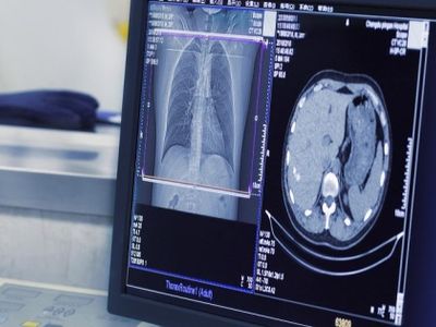 В Челябинске запустили пилотный сервис по предиктивному анализу рентгеновских снимков и компьютерной томографии